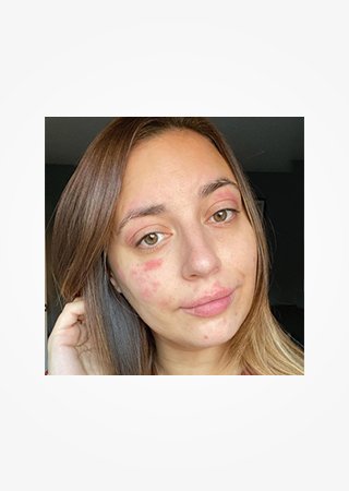 https://www.laroche-posay.cz/-/media/project/loreal/brand-sites/lrp/emea/tsh/simple-page/landing-page/brand-campaign/flip_card/flip_card-03.jpg