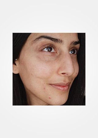 https://www.laroche-posay.cz/-/media/project/loreal/brand-sites/lrp/emea/tsh/simple-page/landing-page/brand-campaign/flip_card/flip_card-04.jpg