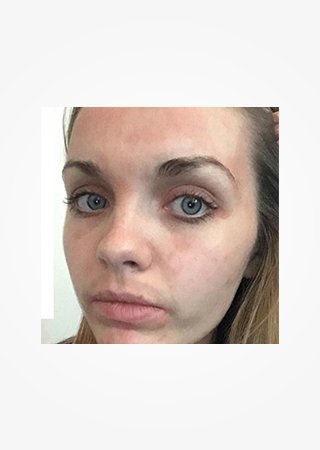 https://www.laroche-posay.cz/-/media/project/loreal/brand-sites/lrp/emea/tsh/simple-page/landing-page/brand-campaign/flip_card/flip_card-05.jpg