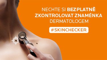 Skinchecker banner image mobile cz